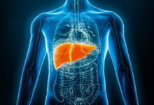 Este alimento combate a gordura no fígado e regula o colesterol