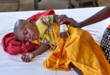 Metade das crianças no sul de Angola sofre de desnutrição crónica