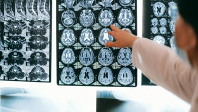 Nova técnica brasileira pode diagnosticar Alzheimer com simples teste