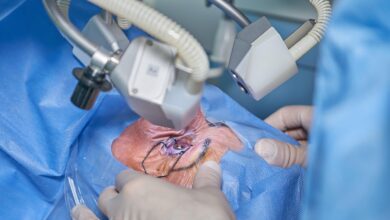 Você passou por cirurgia de catarata? Veja como garantir o auxílio-doença agora