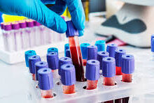 Estudo revela como o sangue pode retardar o envelhecimento