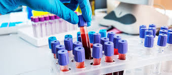 Estudo revela como o sangue pode retardar o envelhecimento