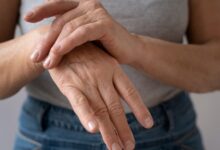 Cientistas encontram método simples que alivia artrite sem precisar de medicamentos