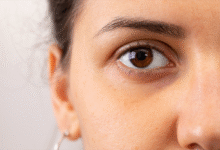 soluções naturais para eliminar cansaço no rosto