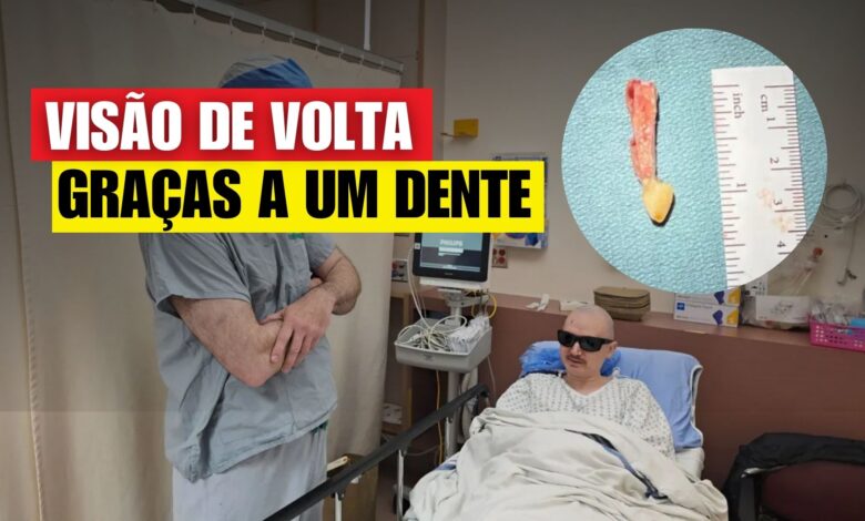 Homem volta a enxergar após 20 anos de cegueira com rara cirurgia que usa um dente para sustentar lente no olho. Técnica inédita no Canadá.