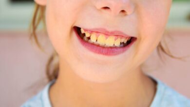 Achava que era descuido? Veja por que seus dentes podem ficar amarelos mesmo com higiene impecável