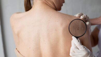 Os fatores que promovem o surgimento de verrugas e como preveni-las