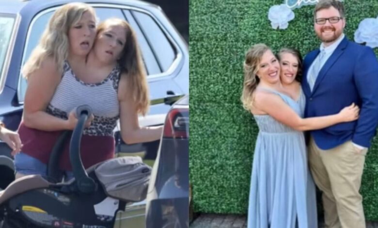 Aos 35 Anos, Gêmeas Abby e Brittany Aparecem com Recém-Nascido e Detalhe Revolta Chocam Seguidores "Elas Fizeram S… Ver mais