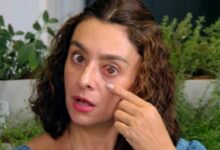 Catia Fonseca pega a todos de surpresa ao falar de problema de saúde; "Estou com c... Ver mais