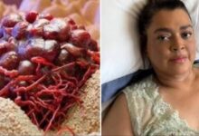 10 Cheiros de Câncer que as Pessoas Costumam Ignorar – Muito cuidado com 5... Veja mais