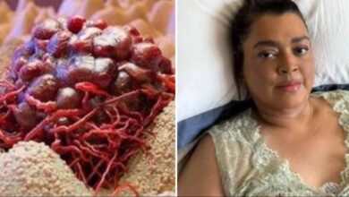 10 Cheiros de Câncer que as Pessoas Costumam Ignorar – Muito cuidado com 5... Veja mais