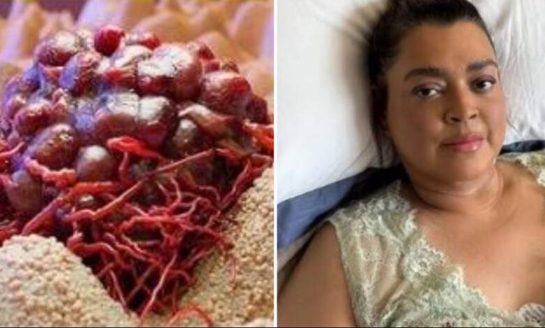 10 Cheiros de Câncer que as Pessoas Costumam Ignorar – Muito cuidado com 5... Veja mais