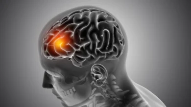 O que causa a meningite tipo C?