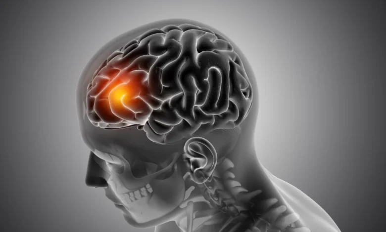 O que causa a meningite tipo C?