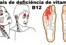 Muitas pessoas sentem a carência de vitamina B12, mas nem imaginam. Veja os principais sintomas... Ver +
