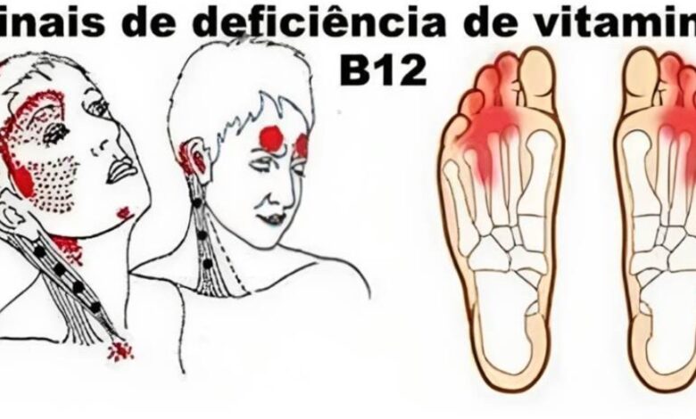 Muitas pessoas sentem a carência de vitamina B12, mas nem imaginam. Veja os principais sintomas... Ver +