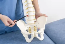 Como descobrir que tenho hérnia de disco?