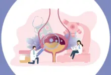 Infecção urinária de repetição: entenda por que afeta mais as mulheres