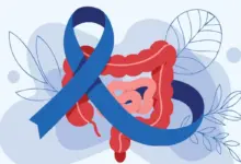 Março Azul-Marinho: veja atividades físicas que ajudam no combate ao câncer colorretal