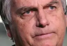 o que é o quadro que levou Bolsonaro à UTI?