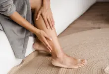 Intestino preso e varizes: qual a relação e como aliviar os sintomas