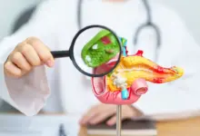 Pedra na vesícula: conheça os sintomas da doença