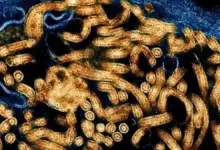 Paciente com suspeita de ebola está internado em São Paulo