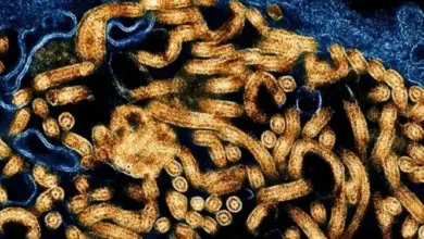Paciente com suspeita de ebola está internado em São Paulo