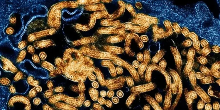 Paciente com suspeita de ebola está internado em São Paulo