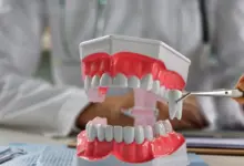Presente em grande parte da população, o siso pode não encontrar espaço suficiente na arcada dentária e gerar complicações (Imagem: NMK-Studio