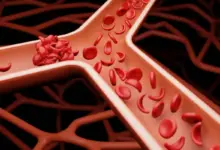 A doença falciforme pode afetar diversos órgãos e requer atenção constante ao longo da vida (Imagem: Funcionário do Amor