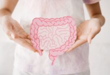 Imagem de uma pessoa com camiseta branca e com as mãos segurando a ilustração de um intestino humano