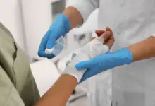 Cuidados adotados logo após a queimadura podem fazer toda a diferença na recuperação (Imagem: New Africa