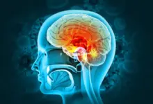 A meningite é a inflamação das meninges, causada por vírus, bactérias, fungos ou parasitas, que afeta cérebro e medula espinhal (Imagem: crystal light