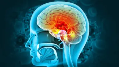 A meningite é a inflamação das meninges, causada por vírus, bactérias, fungos ou parasitas, que afeta cérebro e medula espinhal (Imagem: crystal light