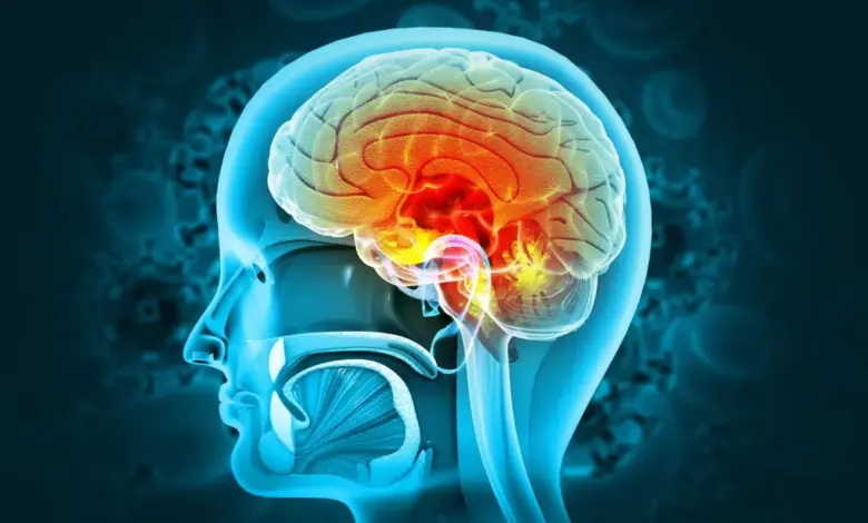 A meningite é a inflamação das meninges, causada por vírus, bactérias, fungos ou parasitas, que afeta cérebro e medula espinhal (Imagem: crystal light