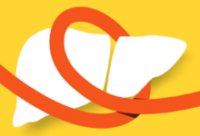 Quando não identificadas e tratadas adequadamente, as hepatites podem evoluir para condições mais graves (Imagem: Nearzoo works