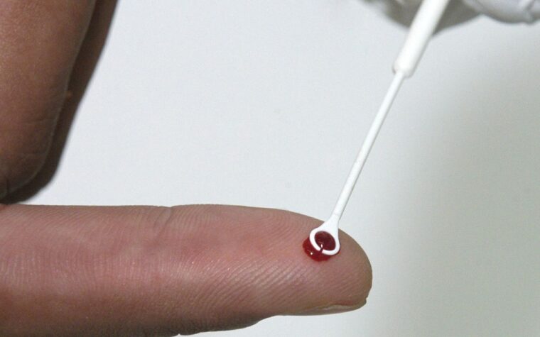 Fiji enfrenta emergência nacional devido ao aumento de casos de HIV