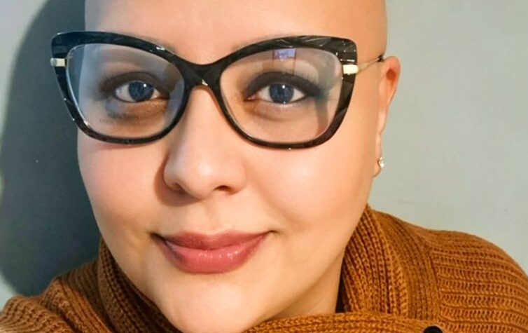 Alopecia areata: relatos de pacientes em busca de autoestima